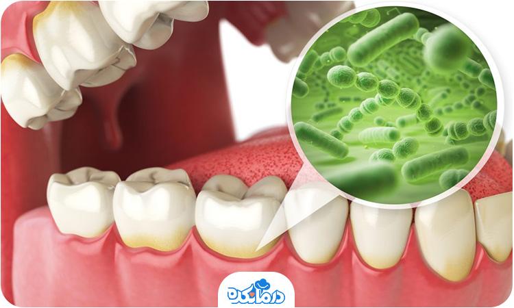 علائم عفونت دندان چیست؟